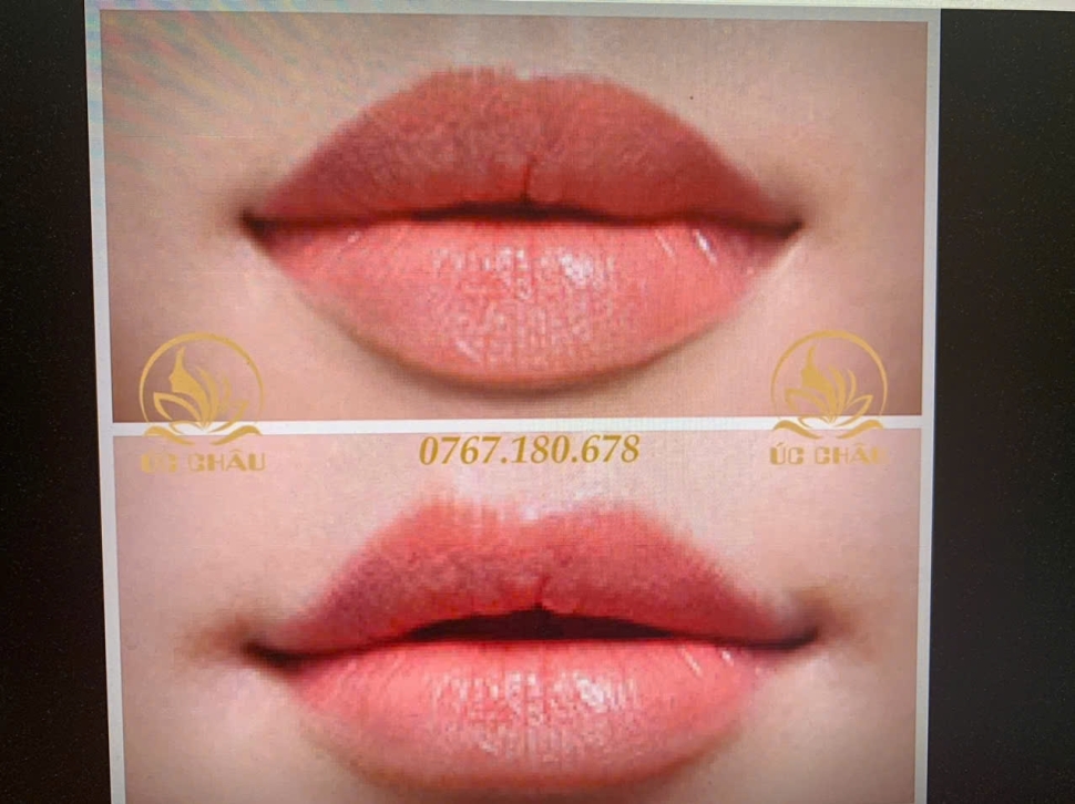 Filler