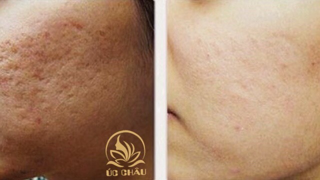 Điều trị Da chuyên sâu Điều trị Da chuyên sâu